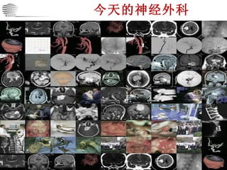 今天的神经外科 