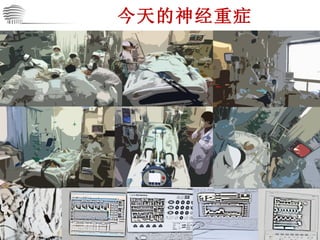 今天的神经重症 