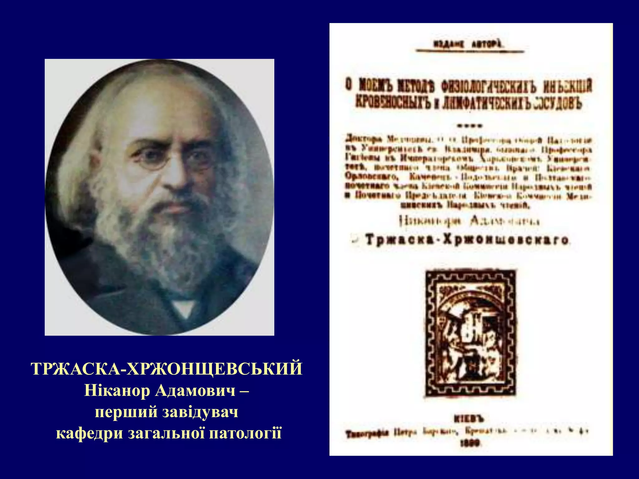 ТРЖАСКА-ХРЖОНЩЕВСЬКИЙ 
Ніканор Адамович – 
перший завідувач 
кафедри загальної патології 
 
