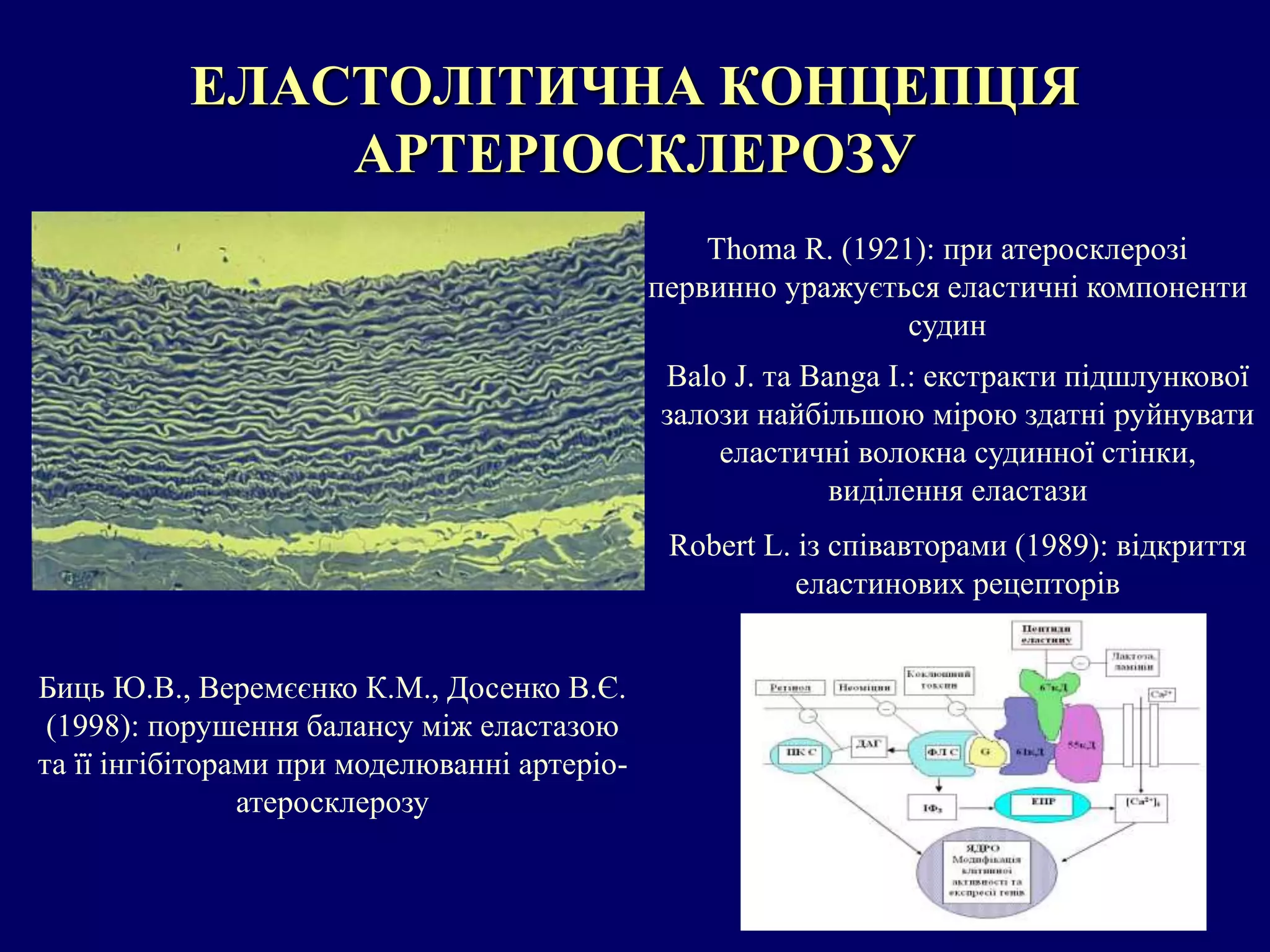 ЕЛАСТОЛІТИЧНА КОНЦЕПЦІЯ 
АРТЕРІОСКЛЕРОЗУ 
Thoma R. (1921): при атеросклерозі 
первинно уражується еластичні компоненти 
судин 
Balo J. та Banga I.: екстракти підшлункової 
залози найбільшою мірою здатні руйнувати 
еластичні волокна судинної стінки, 
виділення еластази 
Robert L. із співавторами (1989): відкриття 
еластинових рецепторів 
Биць Ю.В., Веремєєнко К.М., Досенко В.Є. 
(1998): порушення балансу між еластазою 
та її інгібіторами при моделюванні артеріо- 
атеросклерозу 
 