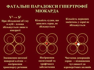 ФАТАЛЬНІ ПАРАДОКСИ ГІПЕРТРОФІЇ МІОКАРДА V 3  ->  S 2 При збільшенні об ` єму в кубі – площа збільшується лише в квадраті Зменшення питомої поверхні клітин  ->  погіршення транспорту речовин Кількість судин, що живлять серце, не збільшується Погіршення оксигенації та трофічного забезпечення Кількість нервових закінчень у серці не збільшується Часткова денервація серця  ->   підвищення чутливості до адренергічних впливів 
