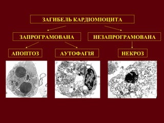 ЗАГИБЕЛЬ КАРДІОМІОЦИТА ЗАПРОГРАМОВАНА НЕЗАПРОГРАМОВАНА АПОПТОЗ АУТОФАГІЯ НЕКРОЗ 