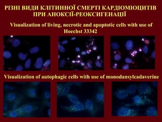 РІЗНІ ВИДИ КЛІТИННОЇ СМЕРТІ КАРДІОМІОЦИТІВ ПРИ АНОКСІЇ-РЕОКСИГЕНАЦІЇ  Visualization of living, necrotic and apoptotic cells with use of Hoechst 33342  Visualization of autophagic cells with use of monodansylcadaverine 