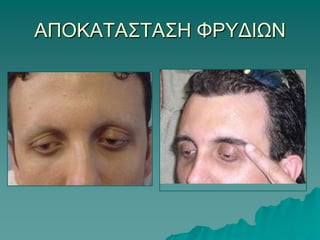 4 ΜΗΝΕΣ