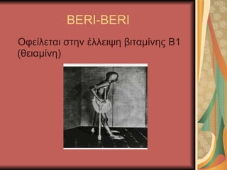 BERI-BERI Οφείλεται στην έλλειψη βιταμίνης Β1 (θειαμίνη) 