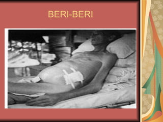 BERI-BERI 