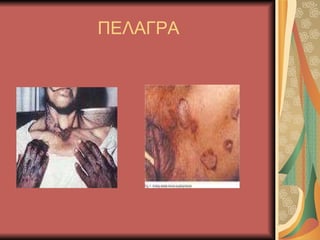 ΠΕΑΓΡΑ 