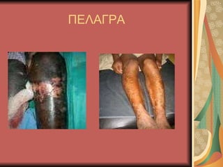 ΠΕΑΓΡΑ 