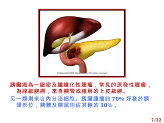 Kһ@ܼwS[Ҋԭl[ټȹܻٷƤ һtԃȷڼK[s 70% ðl^λwβtN 30%  7/22 