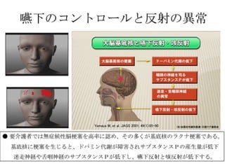 嚥下のコントロールと反射の異常




● 要介護者では無症候性脳梗塞を高率に認め、その多くが基底核のラクナ梗塞である。
 基底核に梗塞を生じると、ドパミン代謝が障害されサブスタンスＰの産生量が低下
  迷走神経や舌咽神経のサブスタンスＰが低下し、嚥下反射と咳反射が低下する。
 