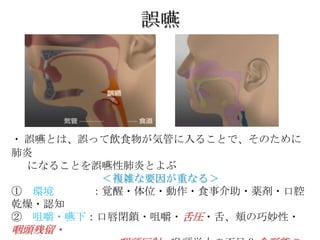 誤嚥




・ 誤嚥とは、誤って飲食物が気管に入ることで、そのために
肺炎
  になることを誤嚥性肺炎とよぶ
         ＜複雑な要因が重なる＞
① 環境    ：覚醒・体位・動作・食事介助・薬剤・口腔
乾燥・認知
② 咀嚼・嚥下：口唇閉鎖・咀嚼・舌圧・舌、頬の巧妙性・
咽頭残留・
 