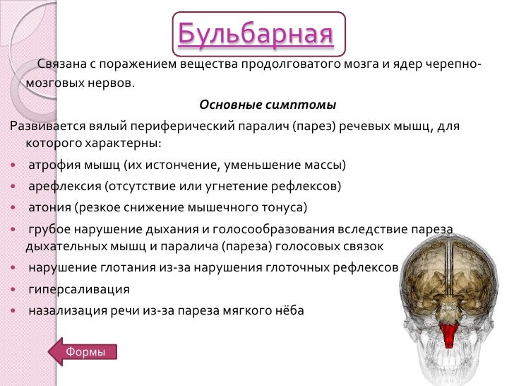 Моторная дизартрия это