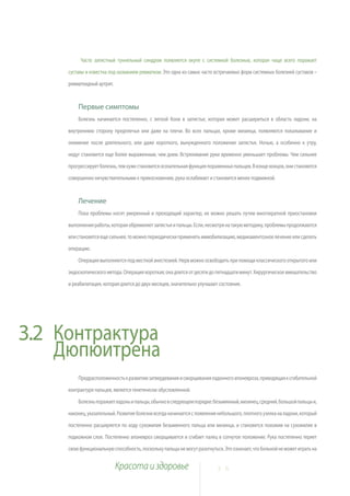 Часто запястный туннельный синдром появляется вкупе с системной болезнью, которая чаще всего поражает

     суставы и известна под названием ревматизм. Это одна из самых часто встречаемых форм системных болезней суставов –

     ревматоидный артрит.



         Первые симптомы
         Болезнь начинается постепенно, с легкой боли в запястье, которая может расшириться в область ладони, на

     внутреннюю сторону предплечья или даже на плечи. Во всех пальцах, кроме мизинца, появляются покалывание и

     онемение после длительного, или даже короткого, вынужденного положения запястья. Ночью, а особенно к утру,

     недуг становится еще более выраженным, чем днем. Встряхивание руки временно уменьшает проблемы. Чем сильнее

     прогрессирует болезнь, тем хуже становится осязательная функция пораженных пальцев. В конце концов, они становятся

     совершенно нечувствительными к прикосновению, рука ослабевает и становится менее подвижной.


         Лечение
         Пока проблемы носят умеренный и преходящий характер, их можно решать путем многократной приостановки

     выполнения работы, которая обременяет запястья и пальцы. Если, несмотря на такую методику, проблемы продолжаются

     или становятся еще сильнее, то можно периодически применять иммобилизацию, медикаментозное лечение или сделать

     операцию.

         Операция выполняется под местной анестезией. Нерв можно освободить при помощи классического открытого или

     эндоскопического метода. Операция короткая; она длится от десяти до пятнадцати минут. Хирургическое вмешательство

     и реабилитация, которая длится до двух месяцев, значительно улучшают состояние.




3.2 Контрактура
    Дюпюитрена
         Предрасположенность к развитию затвердевания и сморщивания ладонного апоневроза, приводящая к сгибательной

     контрактуре пальцев, является генетически обусловленной.

         Болезнь поражает ладонь и пальцы, обычно в следующем порядке: безымянный, мизинец, средний, большой пальцы и,

     наконец, указательный. Развитие болезни всегда начинается с появления небольшого, плотного узелка на ладони, который

     постепенно расширяется по ходу сухожилия безымянного пальца или мизинца, и становится похожим на сухожилие в

     подкожном слое. Постепенно апоневроз сморщивается и сгибает палец в согнутое положение. Рука постепенно теряет

     свою функциональную способность, поскольку пальцы не могут разогнуться. Это означает, что больной не может играть на


                            Красота и здоровье                            2 6
 