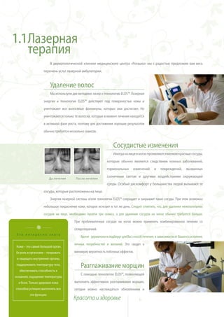 1.1Лазерная
   терапия
                         В дерматологической клинике медицинского центра «Рогашка» мы с радостью предложим вам весь

                   перечень услуг лазерной амбулатории.



                         Удаление волос
                         Мы используем две методики: лазер и технологию ELOS™. Лазерная

                   энергия и технология ELOS™ действуют под поверхностью кожи и

                   уничтожают все волосяные фолликулы, которых они достигают. Но

                   уничтожаются только те волоски, которые в момент лечения находятся

                   в активной фазе роста, поэтому для достижения хороших результатов

                   обычно требуется несколько сеансов.



                                                                    Сосудистые изменения
                                                                    Иногда на лице и ногах проявляются мелкие красные сосуды,

                                                               которые обычно являются следствием кожных заболеваний,

                                                               гормональных       изменений      и   повреждений,       вызванных

                                                               солнечным светом и другими воздействиями окружающей
                         До лечения       После лечения
                                                               среды. Особый дискомфорт у большинства людей вызывают те

                   сосуды, которые расположены на лице.

                         Энергия лазерной системы и/или технологии ELOS™ сокращает и закрывает такие сосуды. При этом возможно

                   небольшое покраснение кожи, которое исчезает в тот же день. Следует отметить, что, для удаления нежелательных

                   сосудов на лице, необходимо пройти три сеанса, а для удаления сосудов на ногах обычно требуется больше.

                                         При проблематичных сосудах на ногах можно применять комбинированное лечение со

                                         склеротерапией.
 Это интересно знать
                                             Врачи - дерматологи подберут для Вас способ лечения, в зависимости от Вашего состояния,

                                         личных потребностей и желаний. Это сводит к
 Кожа – это самый большой орган.
Ее роль в организме – покрывать          минимуму вероятность побочных эффектов.
 и защищать внутренние органы,
 поддерживать температуру тела,
                                             Разглаживание морщин
   обеспечивать способность к
                                             С помощью технологии ELOS™, позволяющей
осязанию, ощущению температуры
  и боли. Только здоровая кожа           выполнять эффективное разглаживание морщин,
способна успешно выполнять все           сегодня можно наслаждаться обновлением и
          эти функции.
                                        Красота и здоровье                            6
 