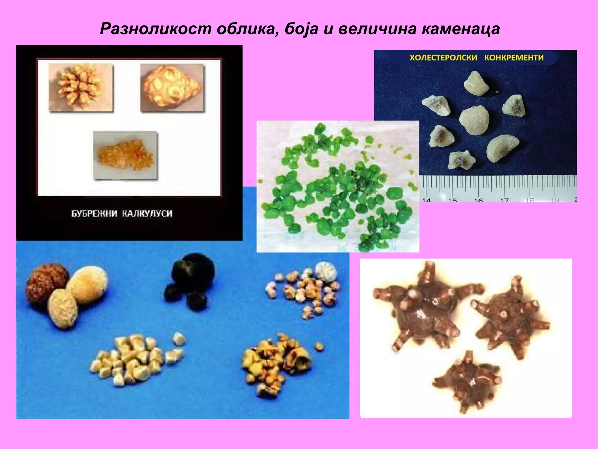 Разноликост облика, боја и величина каменаца 