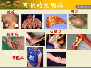 可怕的文明病
癌症             肝病



         心脏病
糖尿病




 肾脏病
 