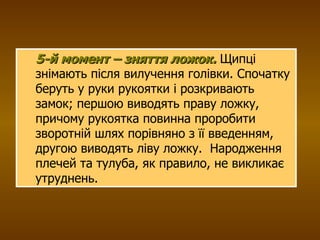 5-й момент – зняття ложок.   Щипці знімають після вилучення голівки. Спочатку беруть у руки рукоятки і розкривають замок; першою виводять праву ложку, причому рукоятка повинна проробити зворотній шлях порівняно з її введенням, другою виводять ліву ложку.  Народження плечей та тулуба, як правило, не викликає утруднень. 