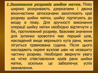 1.Зашивання розривів шийки матки.  Піхву широко розкривають дзеркалами і двома вікончастими затискачами захоплюють краї розриву шийки матки, шийку підтягують до входу в піхву. Для зручності виконання операції шийку матки необхідно відтягнути у бік, протилежний розриву. Важливе значення для зупинки кровотечі має перший шов, накладений вище верхнього кута рани, яким лігується травмована судина. Після цього накладають окремі вузлові шви на незашиту частину розриву. Необхідно звернути увагу на чітке співставлення країв рани шийки матки, оскільки це забезпечує успіх заживлення. 