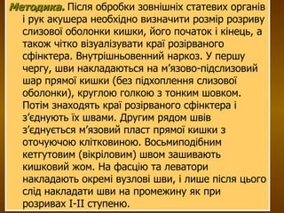 Методика.  Після обробки зовнішніх статевих органів і рук акушера необхідно визначити розмір розриву слизової оболонки кишки, його початок і кінець, а також чітко візуалізувати краї розірваного сфінктера. Внутрішньовенний наркоз. У  першу чергу, шви накладаються на м’язово-підслизовий шар прямої кишки (без підхоплення слизової оболонки), круглою голкою з тонким шовком. Потім знаходять краї розірваного сфінктера і з’єднують їх швами. Другим рядом швів з’єднується м’язовий пласт прямої кишки з оточуючою клітковиною. Восьмиподібним кетгутовим (вікріловим) швом зашивають кишковий жом. На фасцію та леватори накладають окремі вузлові шви, і лише після цього слід накладати шви на промежину як при розривах І-ІІ ступеню.  