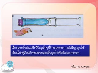 เมื่อปล่อยนิ้วหัวแม่มือที่ปิดรูเล็กๆที่ข้างหลอดออก แล้วดึงลูกสูบให้
เลื่อนไปอยู่ด้านท้ายของหลอดจะเห็นลูกโป่งยืดตัวและพองออก


                                                       ฉวีวรรณ นาคบุตร
 