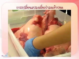 การเปลี่ยนแปลงเมื่อเป่าลมเข้าปอด
 