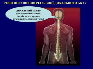 РІВНІ ПОРУШЕННЯ РЕГУЛЯЦІЇ ДИХАЛЬНОГО АКТУ ДИХАЛЬНИЙ ЦЕНТР  (синдром сонних апное, ішемія мозку, травма, пухлина, інтоксикація та ін.) 