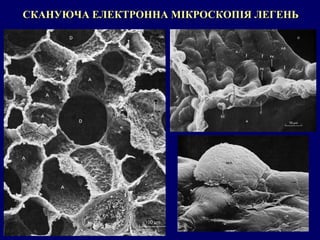 СКАНУЮЧА ЕЛЕКТРОННА МІКРОСКОПІЯ ЛЕГЕНЬ 