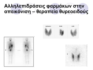 Αλληλεπιδράσεις φαρμάκων στην απεικόνιση  –  θεραπεία θυρεοειδούς 