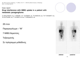26 ετών Παραγαγγλίωμα –  “M” 7 MIBG  θεραπείες Τοξικομανής Σε πρόγραμμα μεθαδόνης 