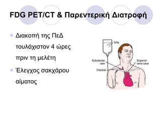 FDG PET/CT &  Παρεντερική Διατροφή Διακοπή της ΠεΔ τουλάχιστον 4 ώρες πριν τη μελέτη Έλεγχος σακχάρου αίματος 