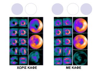 ΧΩΡΙΣ ΚΑΦΕ  ΜΕ ΚΑΦΕ 