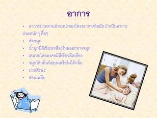 • อาการปวดตามตาแหน่งของโพรงอากาศไซนัส มักเป็ นอาการ
ปวดหนักๆ ตื ้อๆ
• คัดจมูก
• น ้ามูกมีสีเขียวเหลืองไหลออกทางจมูก
• เสมหะไหลลงคอมีสีเขียวสีเหลือง
• จมูกได้ กลิ่นน้ อยลงหรื อไม่ได้ กลิ่น
• ปวดศีรษะ
• อ่อนเพลีย
 