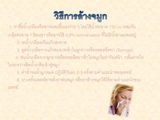 1. หาซื ้อน ้าเกลือหรื ออาจผสมขึ ้นเองง่าย ๆ โดยใช้ น ้าสะอาด 750 cc ผสมกับ
เกลือสะอาด 1 ช้ อนชา หรื ออาจใช้ 0.9% normal saline ที่ไม่มีน ้าตาลผสมอยู่
      2. เทน ้าเกลือลงในแก้ วสะอาด
      3. ดูดน ้าเกลือจากแก้ วสะอาดเข้ าในลูกยางหรื อหลอดฉีดยา (Syringe)
     4. พ่นน ้าเกลือจากลูกยางหรื อหลอฉีดยาเข้ าในจมูกในท่าก้ มหน้ า, กลันหายใจ
                                                                         ้
ในระหว่างฉีดน ้าเกลือเข้ าสูจมูก
                            ่
      5. ทาซ ้าจนน ้ามูกหมด ปฏิบติวนละ 2-3 ครังตามคาแนะนาของแพทย์
                                    ั ั           ้
      6. บางครังแพทย์อาจสังยาพ่นจมูก หรื อยาล้ างจมูกให้ ใช้ ตามคาแนะนาของ
                  ้           ่
แพทย์
 