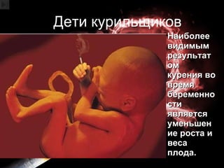 Дети курильщиков Наиболее видимым результатом курения во время беременности является уменьшение роста и веса плода.  