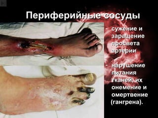 Периферийные сосуды сужение и заращение просвета артерии нарушение   питания тканей, их   онемение и омертвение (гангрена). 