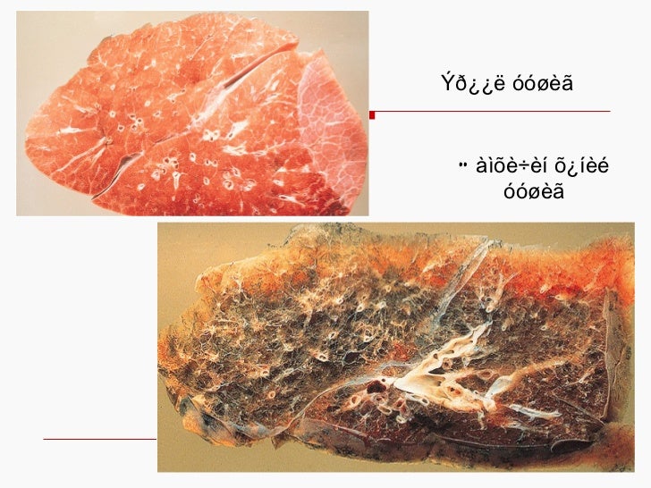 хорт зуршил хичээл н.гэрэлтуяа