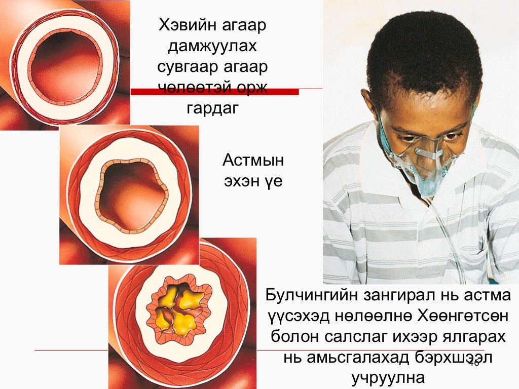 хорт зуршил хичээл н.гэрэлтуяа