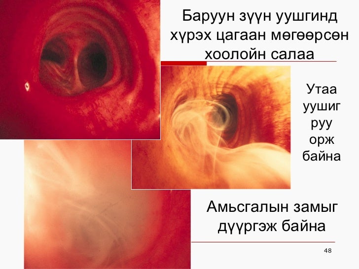 хорт зуршил хичээл н.гэрэлтуяа