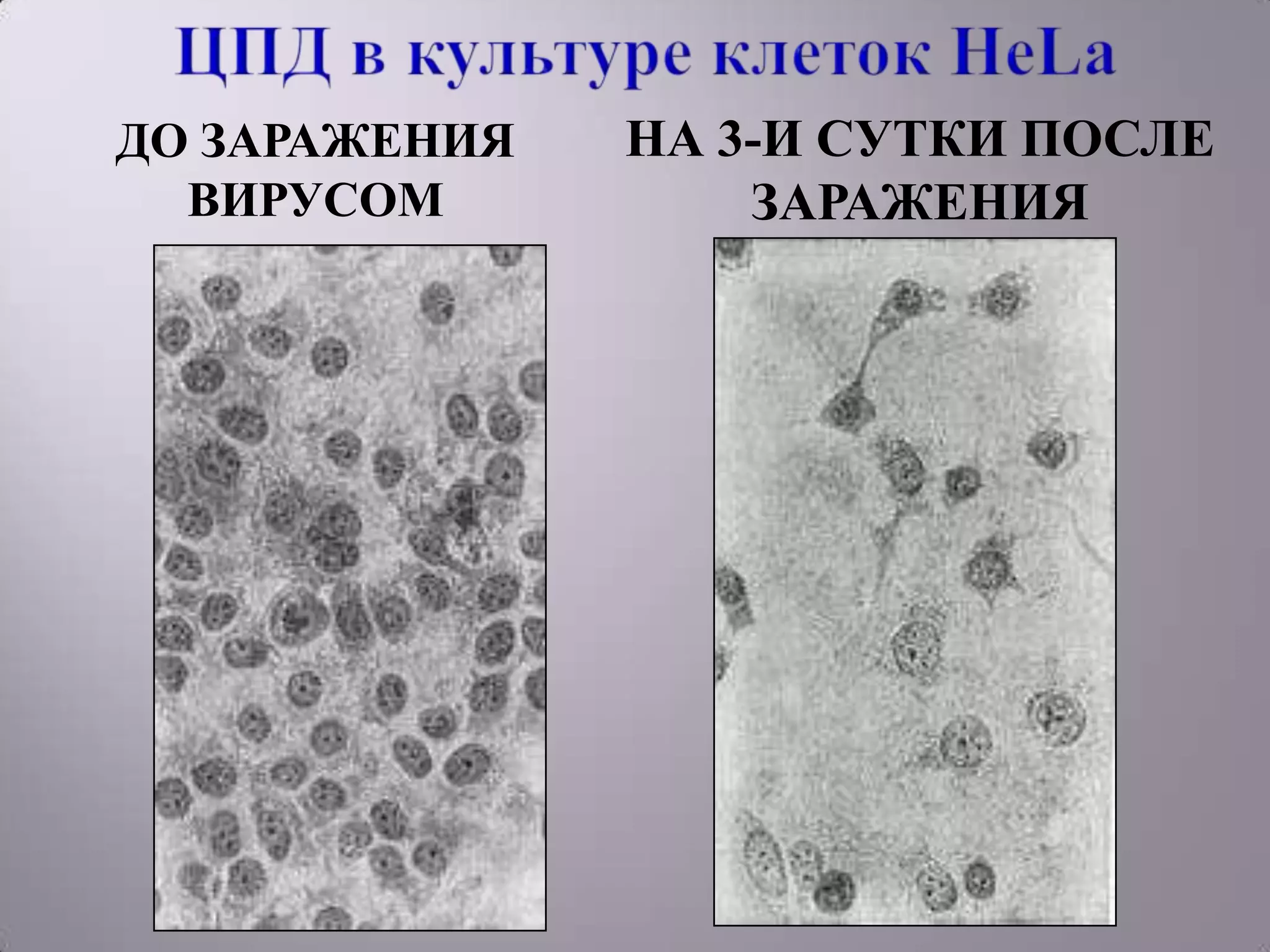 ДО ЗАРАЖЕНИЯ   НА 3-И СУТКИ ПОСЛЕ
  ВИРУСОМ          ЗАРАЖЕНИЯ
 