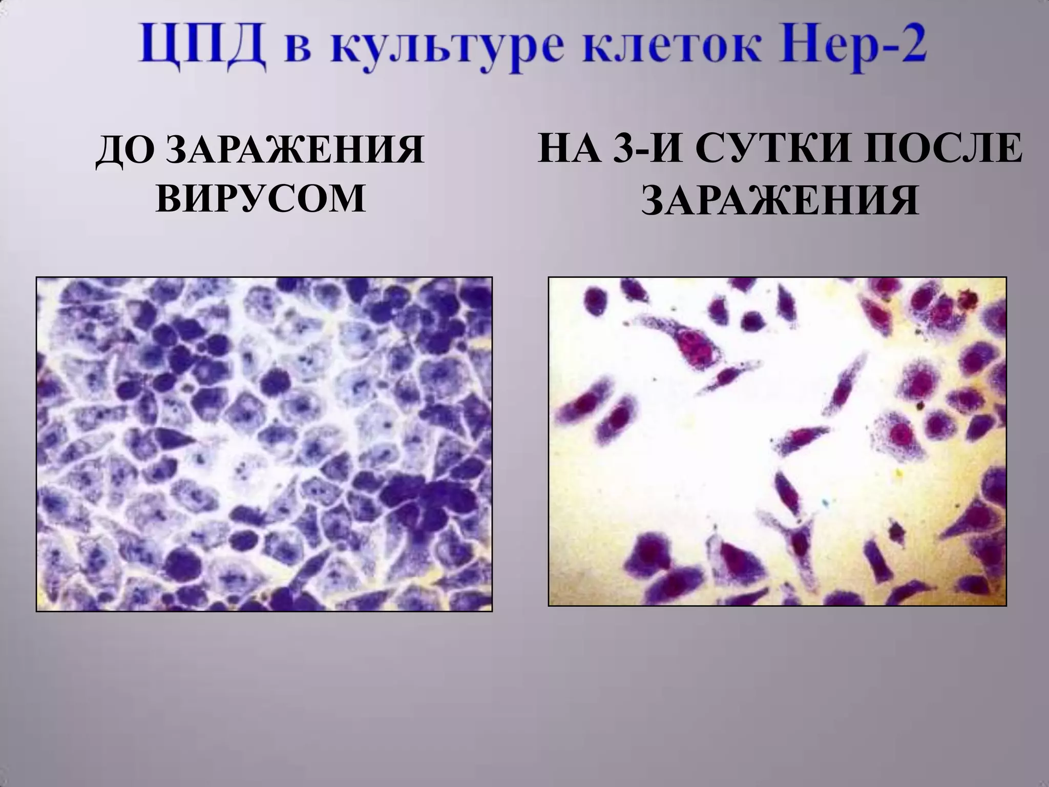 ДО ЗАРАЖЕНИЯ   НА 3-И СУТКИ ПОСЛЕ
  ВИРУСОМ          ЗАРАЖЕНИЯ
 