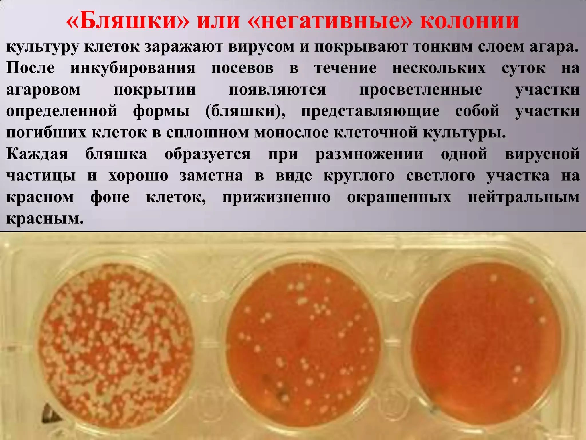 «Бляшки» или «негативные» колонии
культуру клеток заражают вирусом и покрывают тонким слоем агара.
После инкубирования посевов в течение нескольких суток на
агаровом    покрытии     появляются    просветленные    участки
определенной формы (бляшки), представляющие собой участки
погибших клеток в сплошном монослое клеточной культуры.
Каждая бляшка образуется при размножении одной вирусной
частицы и хорошо заметна в виде круглого светлого участка на
красном фоне клеток, прижизненно окрашенных нейтральным
красным.
 