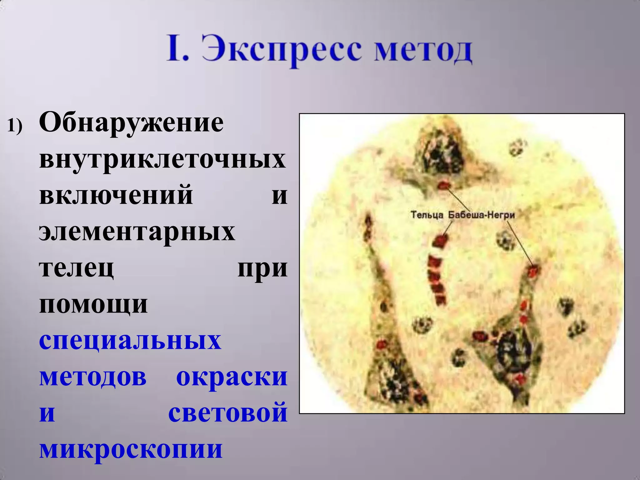 1)   Обнаружение
     внутриклеточных
     включений      и
     элементарных
     телец        при
     помощи
     специальных
     методов окраски
     и       световой
     микроскопии
 