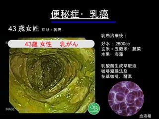 便秘症・乳 癌 每天食用 牛 奶 ・ 起士 ・ 優格 便秘症 狀 ・排便：３～４ 天 一 次 水：１ 天 平均５００ｃｃ 血液相 43 歳 女姓   症 狀 ： 乳癌 乳 癌 治療後 ： 好 水： 2500 cc 玄米＋五穀米・ 蔬 菜・ 水 果・海藻 乳酸菌生成 萃取液 咖啡灌腸法及 花草咖啡 、 酵素 