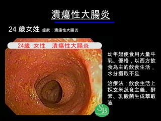 潰瘍性大腸炎 24 歳 女姓   症 狀 ： 潰瘍性大腸炎 幼年起便食用大量牛乳、優格，以西方飲食為主的飲食生活，水分攝取不足 治療法： 飲 食生活 上採 玄米 蔬 食主義、 酵素 、乳酸菌生成 萃取液 