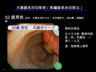 便秘 及便 血 占 ５０％ 的  動物 性飲食 ：肉、乳製品： 一 週 5 ～ 6 次 酒 ：毎 晚喝上兩杯 大腸鏡息肉切除術（ 軟纖維息肉 切除法） 52 歳 男姓   症 狀 ： 大腸息肉約 3cm 、 前 列 腺肥大 、 高血 壓、 高 膽固醇 