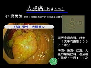 大腸 癌 （約 4 ｃｍ） 47 歳 男姓   症 狀 ： 由於紅 血球 中的自由基造成傷害 毎 天食用 肉類 、 起士 　　１ 天平均攝取 ５００ｃｃ 水分 啤 酒 ・ 燒酒 ・ 紅酒 、 大量的罐裝飲料 、老菸槍 、 排便： 一 週 1 ～ 2 次 