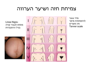 צמיחת חזה ושיער הערווה Linea Nigra- מתחת לטבור קורה בגיל ההתבגרות מדד טאנר להתפתחות סימני מין משניים   Tanner scale 