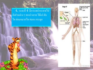 4. ระยะที่ 4 มีการแพร่ กระจายไป
ยังส่ วนต่าง ๆ ของร่ างกาย ได้แก่ ตับ
ไต ต่อมหมวกไต สมอง กระดูก
 