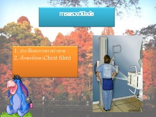 1. ประวัติและการตรวจร่ างกาย
2. เอ็กซเรย์ปอด (Chest film)
 