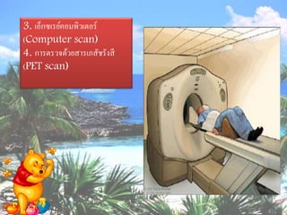3. เอ็กซเรย์คอมพิวเตอร์
(Computer scan)
4. การตรวจด้วยสารเภสัชรังสี
(PET scan)
 